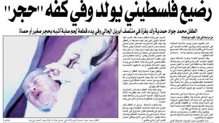 un bebe  né  en  palestine   avec   une  pierre colé  a  sa main